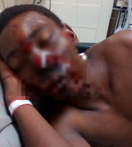 Dominican teen living in Antigua Receives Life Saving Surgeries After Being Mugged